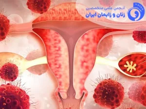غربالگری سرطان سرویکس