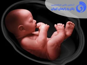 پایداری 2-COV-SARS در جفت در سه ماهه اول