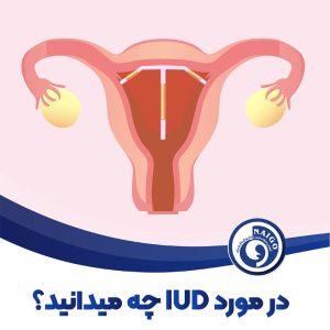 IUD