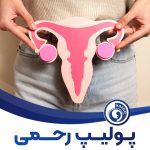 پولیپ رحمی