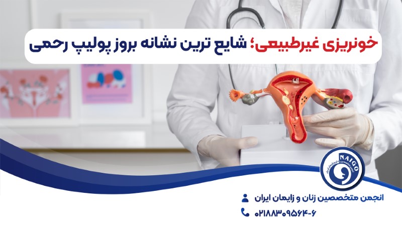 پولیپ رحمی