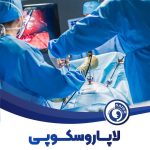عمل لاپاروسکوپی زنان