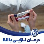 درمان نازایی با روش IUI