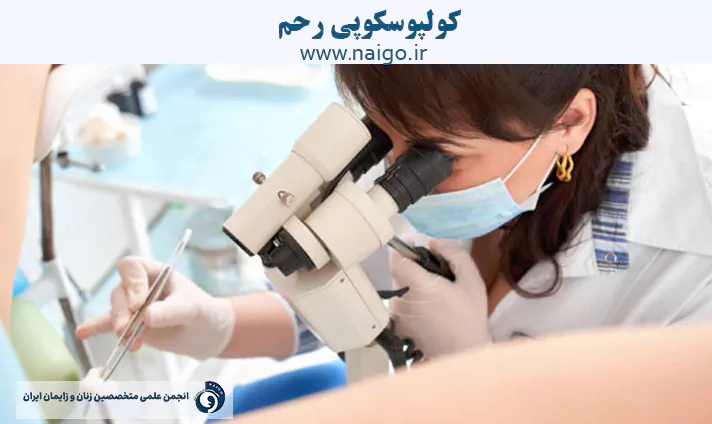 کولپوسکوپی رحم