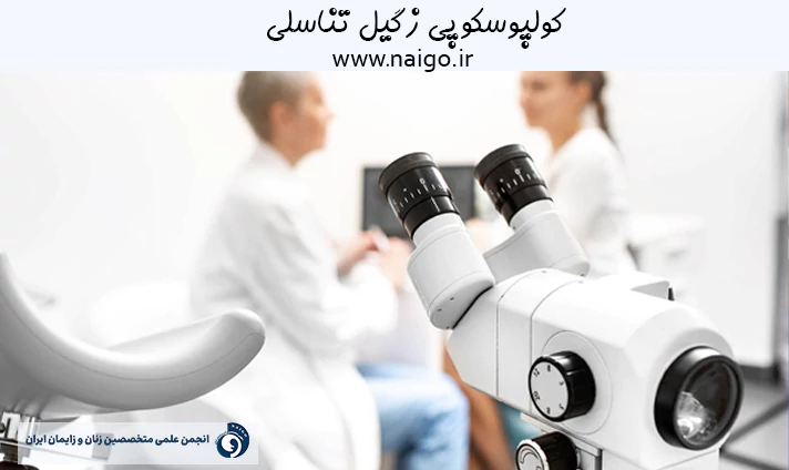 کولپوسکوپی زگیل تناسلی