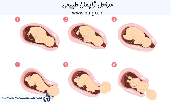 مراحل زایمان طبیعی