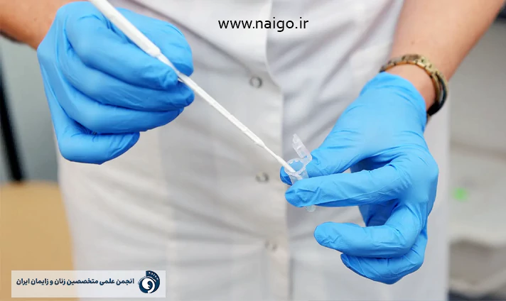 نحوه انجام تست پاپ اسمیر