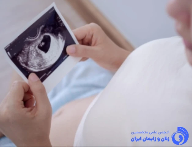 اقدامات قبل از زایمان طبیعی